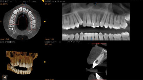 Рентгенологическая диагностика (стоматологическая)